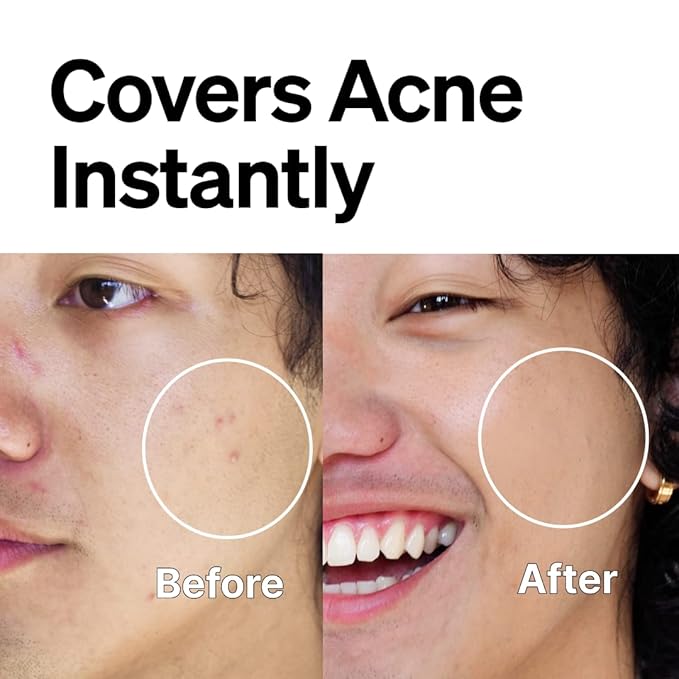 FRONTMAN Fade, Men's Acne Concealer With Salicylic Acid For Acne | For Blemishes & Dark Circles | Natural Coverage, Non-Greasy Formula, Oil-Free, Fragrance-Free | Perfect for All Skin Types | Men’s Concealer D2 Dark Shade-VivaGrace Women