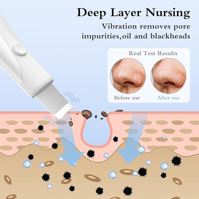 Skin Scrubber Face Spatula Skin Spatula Pore Cleaner Blackhead Remover Tools for Facial Deep Cleansing Skin Care Tool for Men and Women (White)-VivaGrace Women