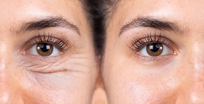 Royal Jelly Eye Beelift-VivaGrace Women