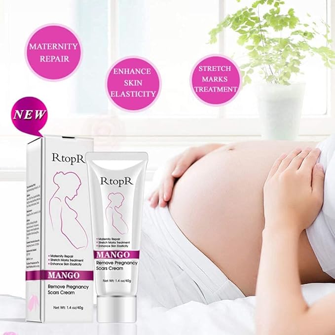 RtopR Mango Stretch Marks and Scar Cream -Stretch Marks and Scar Removal Cream for Pregnancy - Best Body Moisturizer-80g-VivaGrace Women