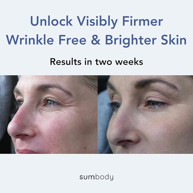 Natural Under Eye Cream Age Defying Plant-Based Retinol Alternative Vegan Eye Repair Moisturizer with Caffeine, antioxidants, Green & white Tea-Prevents Under-eye Wrinkles, Puffiness, Eye Bags-VivaGrace Women