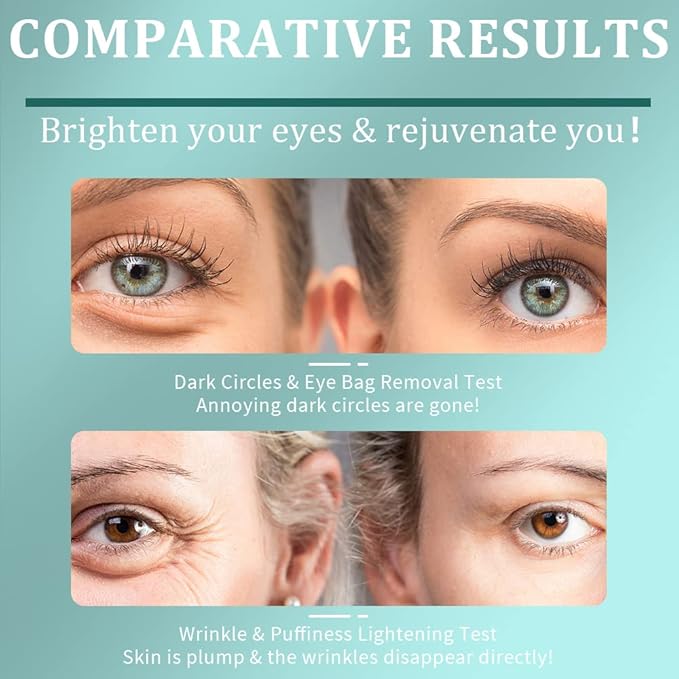 Under Eye Patches, Green Tea Under Collagen Eye Masks for Dark Circles Puffiness Eye Bag Wrinkles, Under Eye Treatment for Men Women, Anti-Aging Brightening Under Eye Gel Pads, 30 Pairs-VivaGrace Women