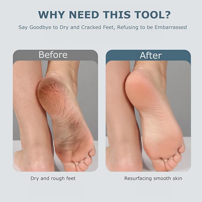 Upgraded Electric Foot Callues Remover, Portable Electric Foot Files with 3 Heads, Rechargeable Feet File for Foot Care, Waterproof Deadskin Remover, Pedicure Tool for Dry and Crack Feet-VivaGrace Women