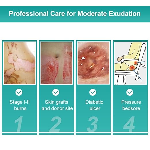 Dimora Hydrocolloid Dressing 4" x 4" for Wound Care, 10 Pack Large Patch Bandages with Self-Adhesive for Bedsore, Burn, Blister, Acne Care, Super Absorbent for Fast Healing-VivaGrace Women