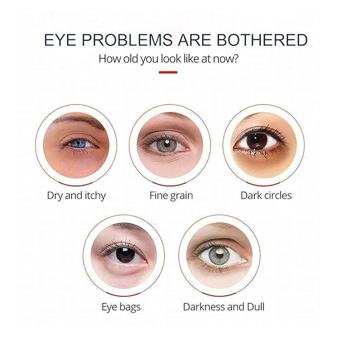 Open eyes awaken peptide lifting eye gel,peptide eye lifting gel,Reduces Dark Circles, Dark circles Hydrating firming Eye cream (5PCS)-VivaGrace Women