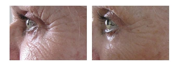 Airelle Age-Defying Eye and Lip Treatment | Anti Aging, Helps Reduce Wrinkles, Fine Lines | Dermatologist Recommended | Hyaluronic Acid, Berrimatrix | Natural Ingredients | .3 Fl Oz-VivaGrace Women