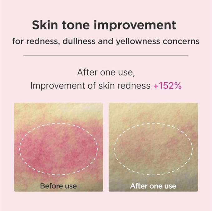 ISOI Blemish Care Up Serum Gift Set, Korean Skin Care for Hydration & Radiance – Full Size or 5-Step Travel Kit Options (5-Step Special Kit (1.77 fl.oz))-VivaGrace Women