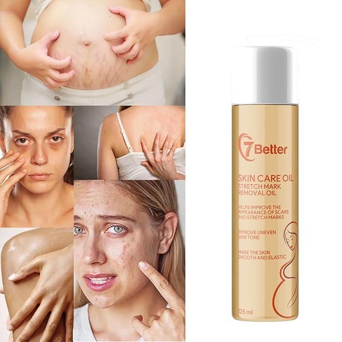 Stretch Mark Pregnancy Oil, Natural Oil Skincare Body Oil Serum for Scars and Stretch Marks, Face with Vitamin E & A for Sensitive Dry Skin and Body Moisturizer-VivaGrace Women