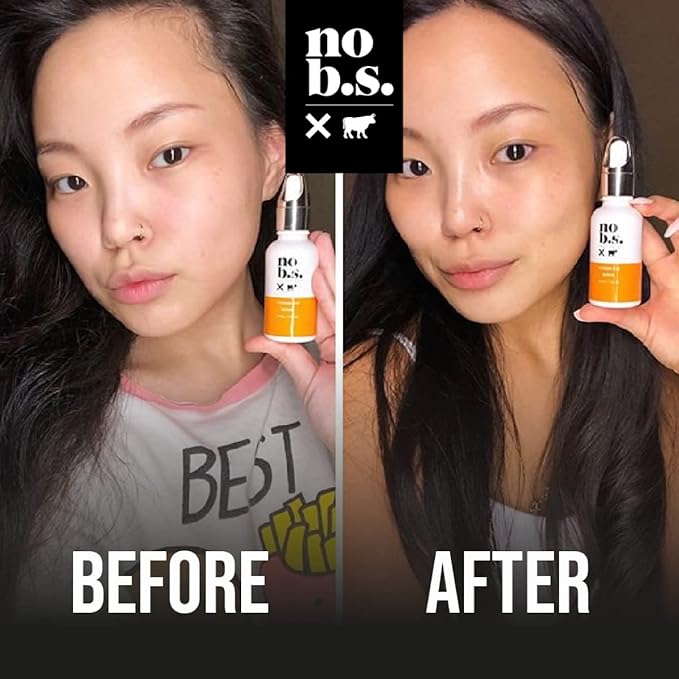 No B.S. (No Bad Stuff) Skincare Minis Kit, Vitamin C & E Serum with Hyaluronic Acid, Retinol Night Cream, Caffeine Eye Cream & Invisible, Waterproof Acne Patches, 4 Product Trial Size-VivaGrace Women