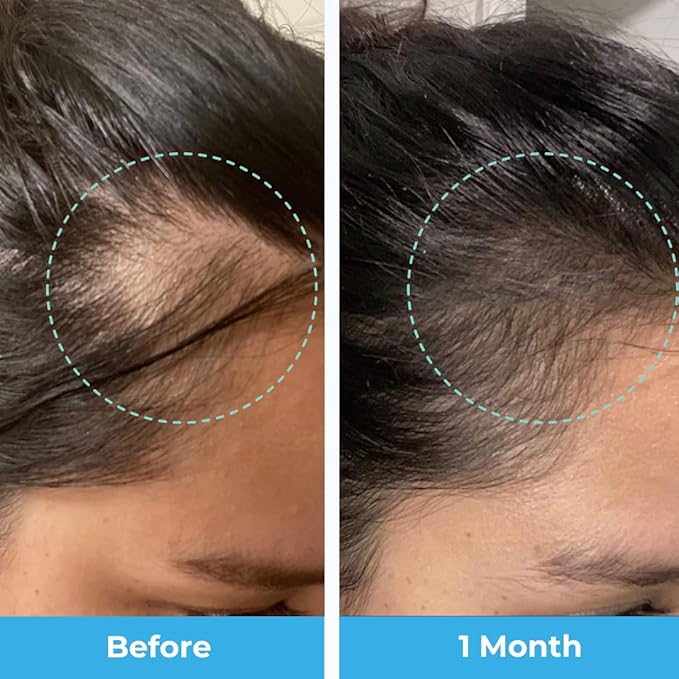 Baby Blues Postpartum Hair Loss Vitamins - Passion Fruit Gummies with Biotin, Collagen, & Folate-VivaGrace Women