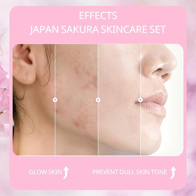 Sakura Skin Care Set, Women Gift Sets, Skin Care Kit with Cleanser, Toner, Serum, Eye Cream, Face Cream, Skin Care Routine Kit for Women, Even Skin Tone, Tighten & Firm Skin-VivaGrace Women