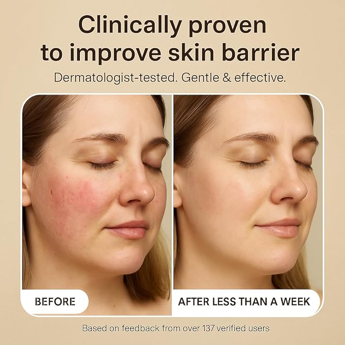 Love Scrub with Hyaluronic Acid Natural Face Exfoliator for Wrinkles, Acne, Fine Lines, Blackheads & Clogged Pores-VivaGrace Women