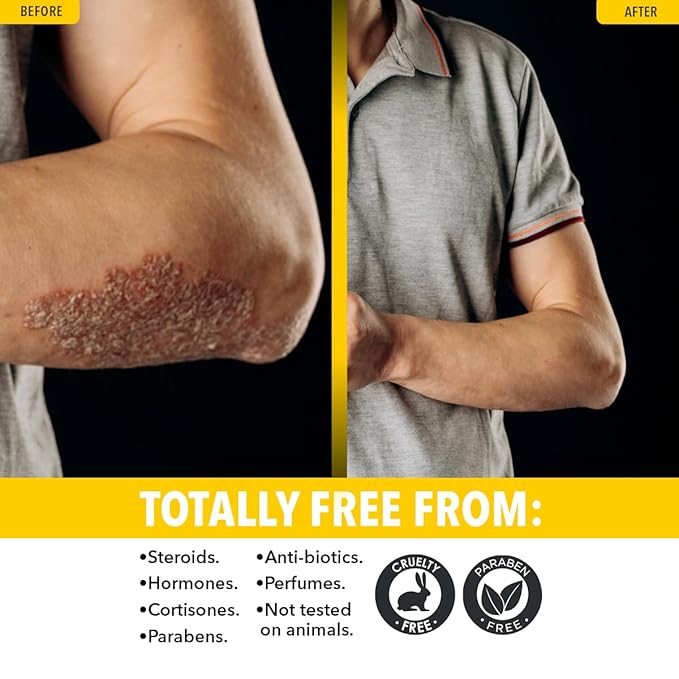 Dr. Robaina Sulfur Balsam Lotion – Lightweight Moisturizer for Dry, Flaky & Itchy Skin – Calms Redness, Supports Skin Barrier & Locks Hydration – Shea Butter & Tea Tree – 8 fl oz, USA Made-VivaGrace Women