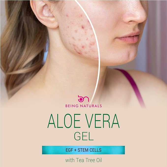 Aloe vera Gel - from 100% Pure Organic Aloe Infused with EGF, Stem Cell, Rosemary Oil - Natural Raw Moisturizer for Face, Body, Hair. Perfect for Sunburn, Acne, Razor Bumps 16.9 fl oz-VivaGrace Women