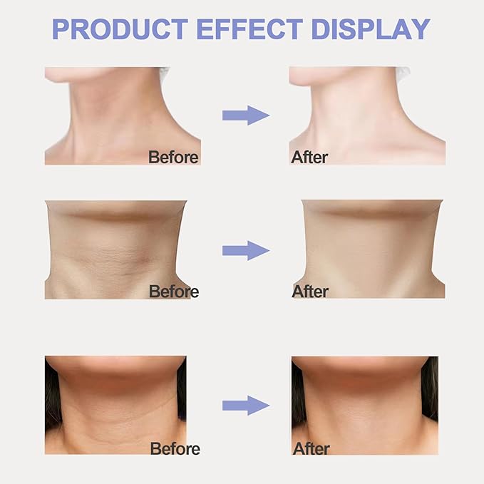 Neck Firming Cream, Neck Tightening Cream, Tighten and Lift Neck Cream, Neck Creams for Tightening and Firming Sagging Skin, Help Reduce Fine Lines & Wrinkles-VivaGrace Women