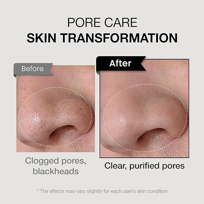 coxir TXA MUCIN ALL-IN-1 PORE MASK –Gelato Texture Wash-Off treatment | Ampoule Mask-to-Foam | Charcoal+ Snail+TXA | Blackhead Remover |Daily Pore Detox for Oily & Sensitive Skin|4.05fl.oz-VivaGrace Women