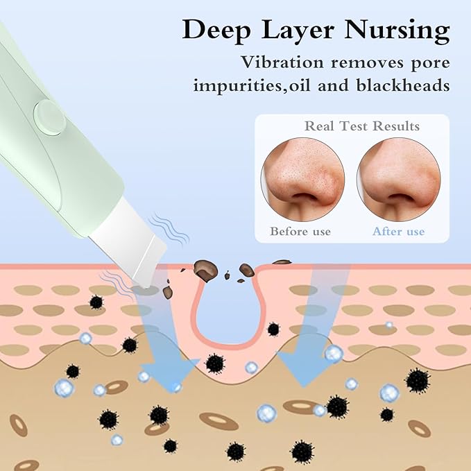 Skin Scrubber Face Spatula Skin Spatula Pore Cleaner Blackhead Remover Tools for Facial Deep Cleansing Skin Care Tool for Men and Women (Green)-VivaGrace Women