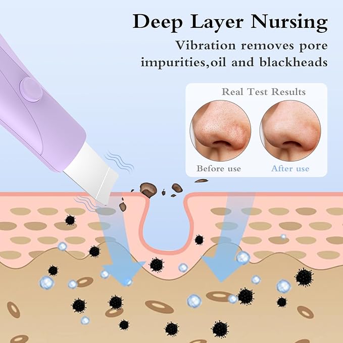 Skin Scrubber Face Spatula Skin Spatula Pore Cleaner Blackhead Remover Tools for Facial Deep Cleansing Skin Care Tool for Men and Women (Purple)-VivaGrace Women