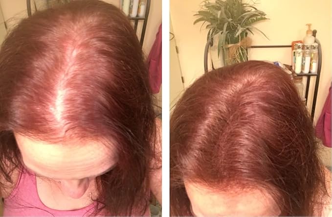 Caboki Sample Size - Get 10X Fuller Hair, Eliminate Bald Spot Instantly. All-Natural, Plant-Based Hair Fibers for Thinning Hair. Light Auburn (red/ginger hair)-VivaGrace Women