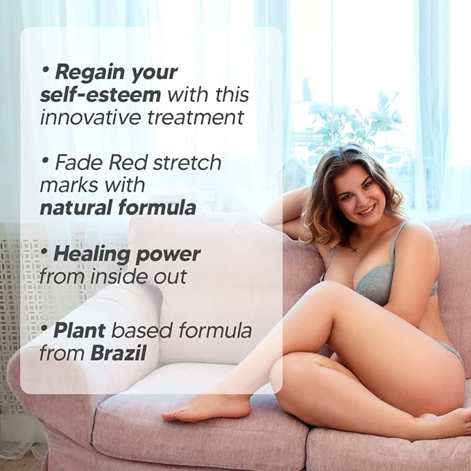 Cicatrissim Red For Removal of Red and Purple Stretch Marks - Innovative Formula With Pure and Powerful Natural Ingredients From Brazilian Flora - For All Skin Types.-VivaGrace Women