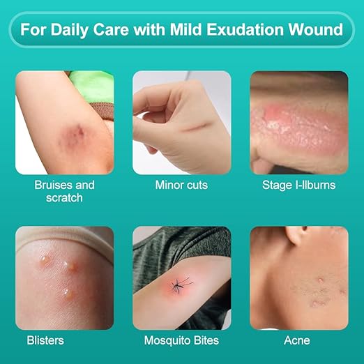 Dimora Hydrocolloid Wound Dressing, 10 Pack Ultra Thin 4" x 4" Large Patch Bandages with Self-Adhesive, Fast Healing for Bedsore, Burn, Blister, Acne Care, Sterile and Waterproof-VivaGrace Women