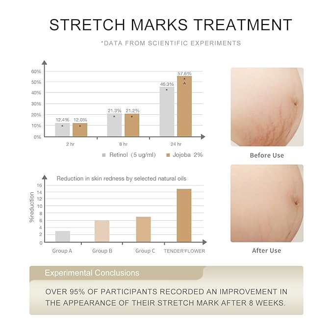 Stretch Mark Oil（110ml）, body oil for Pregnancy,belly oil, belly abdominal Serum Skin Care,Moisturizing Dry Skin, Tender & Softening，True Belly Serum 3.7OZ-VivaGrace Women