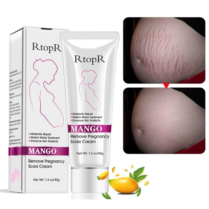 Mango Stretch Marks and Scar Cream, Stretch Marks and Scar Removal Cream for Pregnancy, Stretch Marks Scar Belly Creams for Wrinkles, Obesity Fat Stretch Mark Moisturizing, Remove Marks (40g)-VivaGrace Women