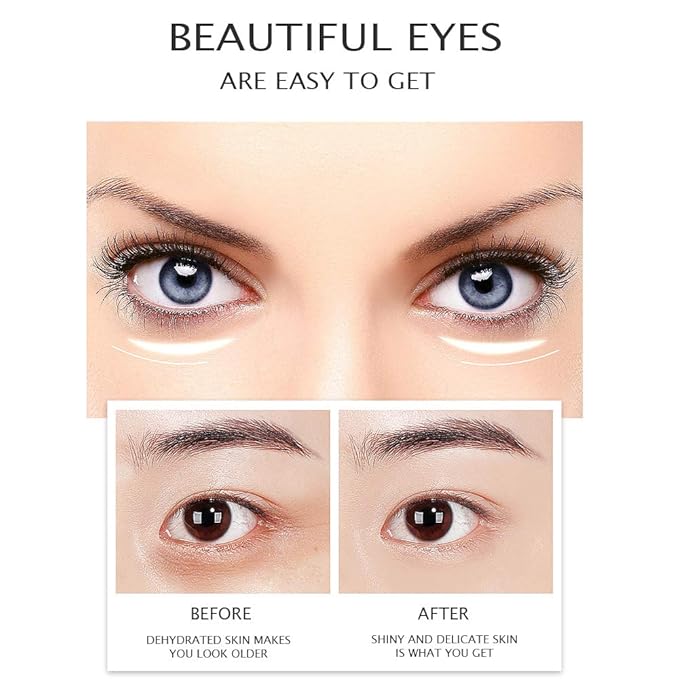 VENZEN Gold Moisturizing Eye Cream Anti Aging Anti Wrinkle Shade Dark Circles Shine Serum Glycerin Delicate Hyaluronic Acid 15g-VivaGrace Women