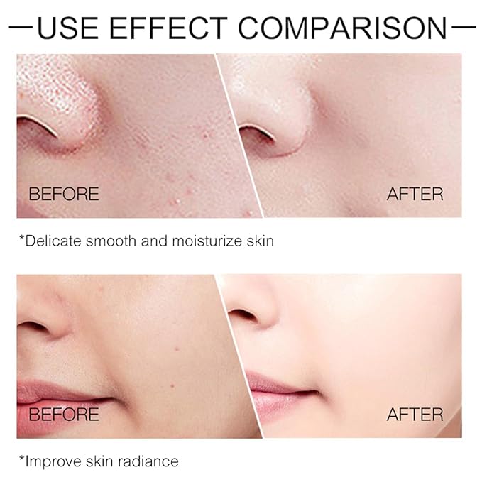 O’KADY 9 Pcs skincare set Anti Aging Skin Daily Care Routine Kit With Vitamin C and Peptides Facial Cleanser Eye Mask Toner Serum Eye Cream Lotion Cream Lady Cream Gifts sets for Valentine's Day-VivaGrace Women
