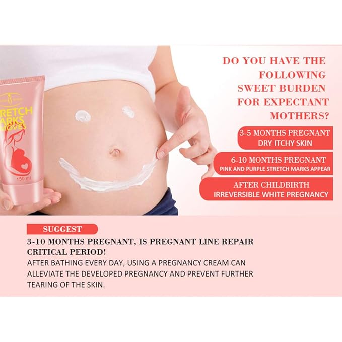 AICHUN BEAUTY Pregnancy Cream Streach Mark Remover Scars Repair Cellulites Lotion Cream 150ml-VivaGrace Women