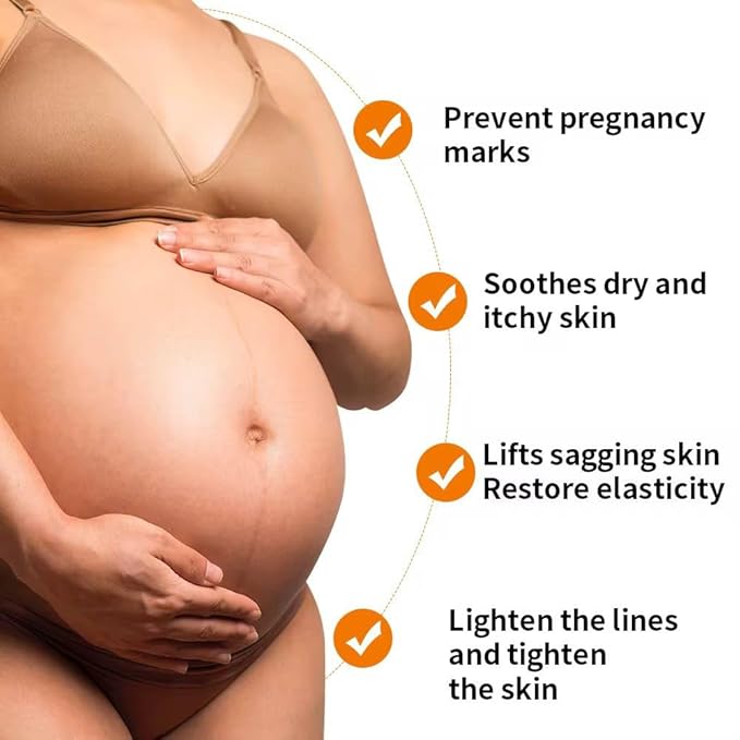 Stretch Mark Pregnancy Oil, Natural Oil Skincare Body Oil Serum for Scars and Stretch Marks, Face with Vitamin E & A for Sensitive Dry Skin and Body Moisturizer-VivaGrace Women