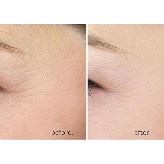 AWARD-WINNING Anti-Age Eye Cream - 5X MORE EFFECTIVE. With 20% Vitamin C & Hyaluronic Acid. Blast away dark circles, eye bags and puffiness - Reduce wrinkles and crow’s feet. Highest strength. 15ml-VivaGrace Women