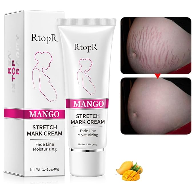 Stretch Mark Removal Cream, Obesity Stretch Mark Moisturizer, Postpartum Repair Stretch Mark Cream, Abdominal Stretch Mark Cream, Remove Marks (1 PCS)-VivaGrace Women