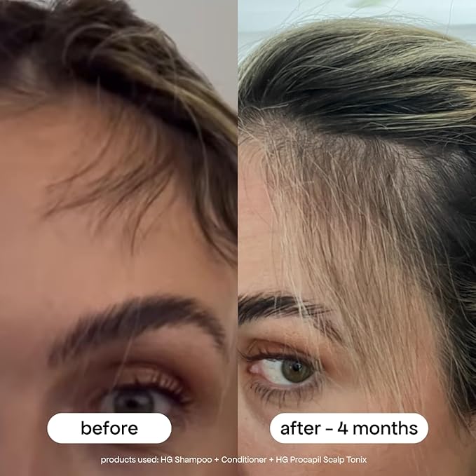 BONDIBOOST Procapil Scalp Treatment [4.23 fl oz], Daily Leave In Treatment for Thinning Hair + Anchor Hair, Scalp Serum for Thicker Hair with Procapil, Rosemary & Biotinoyl Tripeptide-1, Sulfate-Free-VivaGrace Women