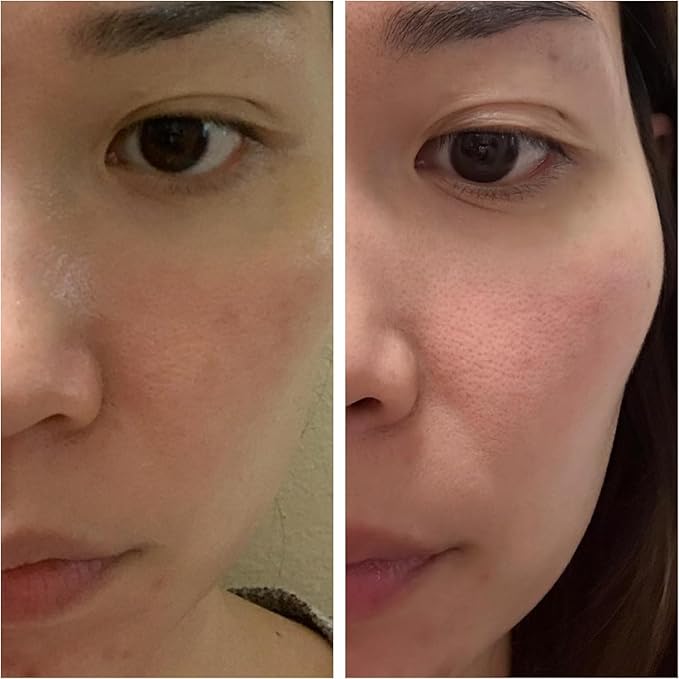 Korean Skin Care Set - Simplified Kbeauty Skincare Kits - Asian Skincare Facial Kit & Sets with Water Based Cleanser, Essence Toner, Under Eye Patches, Face Mask Sheets, Self Care Gifts For Women-VivaGrace Women