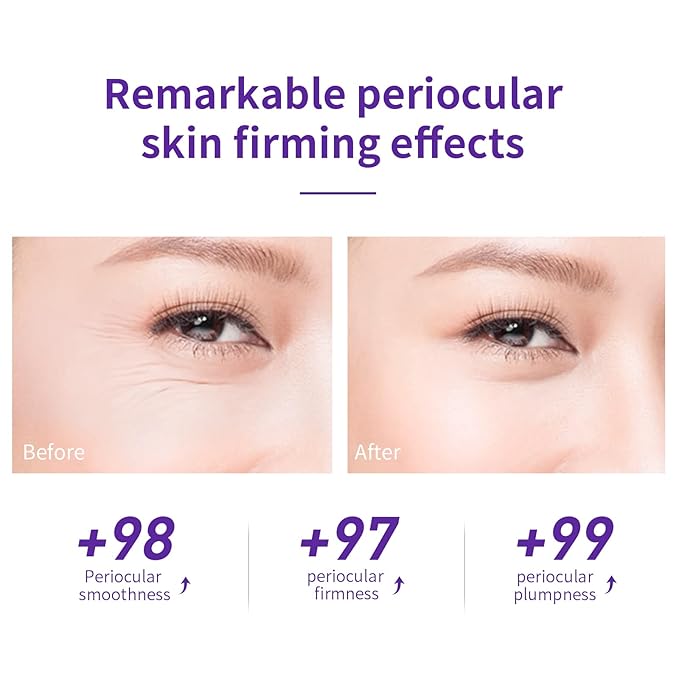 LANBENA Under Eye Cream, Retinol Eye Cream for Dark Circles and Puffiness, Daily Anti-Aging Under Eye Cream with Retinol & Hyaluronic Acid to Fight Fine Lines and Firm Skin (0.68 FL OZ)-VivaGrace Women