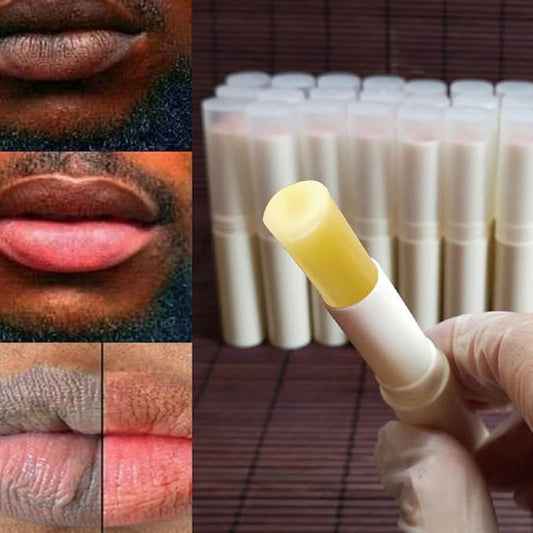 2PCS Handmade Plant lip balm Pink Lips Serum Brighten Dark Lips Bleaching Essence Lip Balm Repair Fine Lines Brighten Moisture Exfoliator Lip Care (Yellow)-VivaGrace Women
