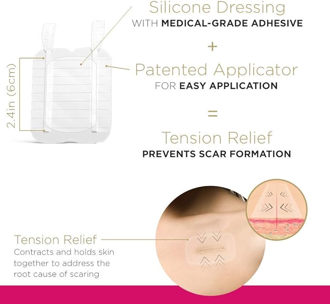 Embrace Active Scar Defense for New Scars, FDA-Cleared Silicone Scar Sheets, 2.4 Inch, Medium, 60 Day Supply (Recommended Treatment)-VivaGrace Women