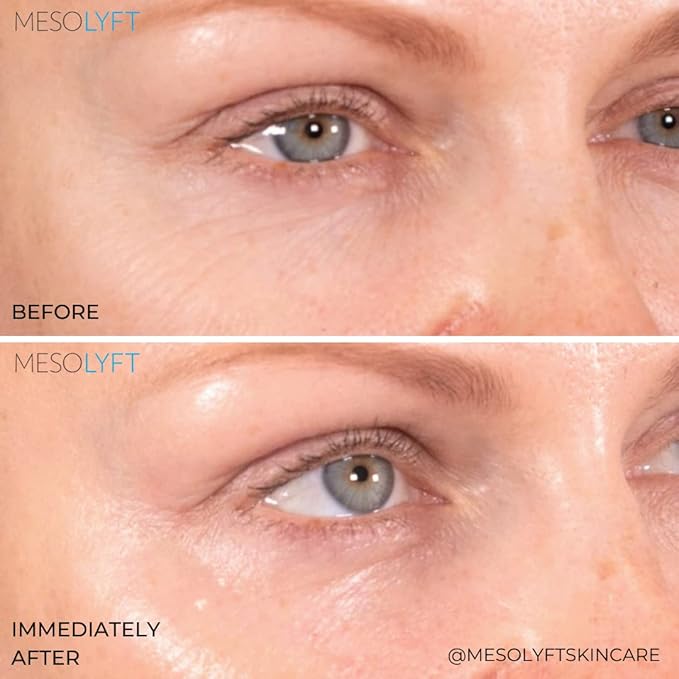 Neck & Eyes Combo Skincare Tool under Eye Serum With Neck Line Remover Neck and Décolletage Beuty Tool & Under Eye Wrinkle Filler Exfoliates the Skin, Visibly Firm & Smooth Necklines-VivaGrace Women