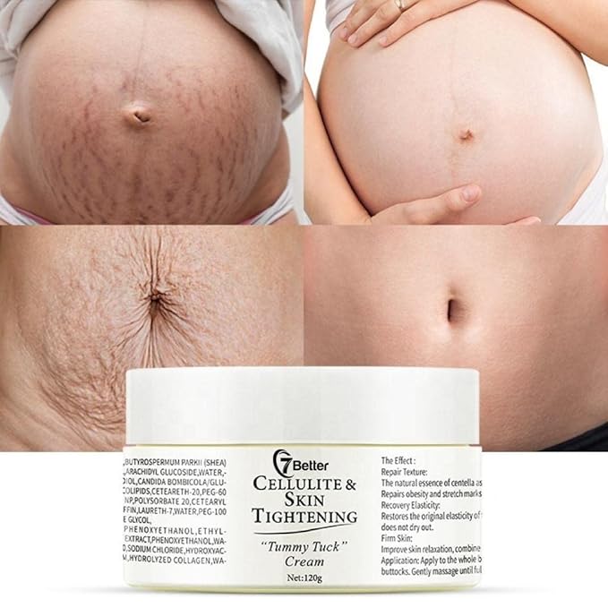 Stretch Marks and Scars Removal Cream for Pregnancy - Scars Repair, Abdominal Firming, and Gentle Stretch Marks Eradication Skincare Body-VivaGrace Women