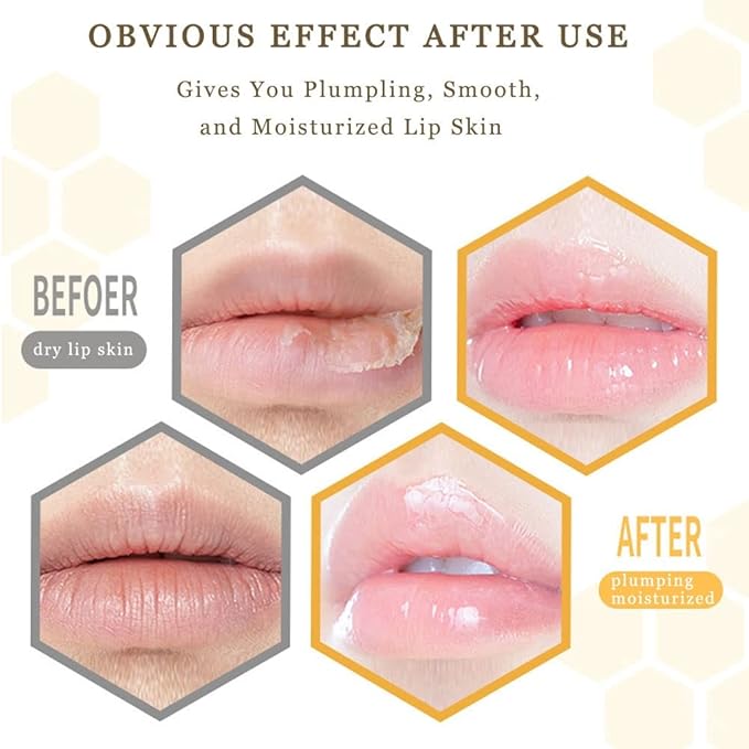 Lip Plumper Lip Mask Set, Bee Balm Lip Balm Honey Pot, Lip Plumper Gloss Lip Injection Honey Moisturizing Lip Sleeping Mask, Hydrating & Prevention Dry and Cracked Lip Scrubs Exfoliator-VivaGrace Women