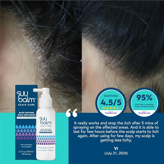 Rapid Itch Relief Anti-Dandruff Scalp Spray Moisturizer, Dry Scalp Spray, Cooling Itchy Scalp Treatment for Flaky Sensitive & Psoriasis, Derm-Formulated. Menthol & 5 Ceramides, 1.35 fl oz-VivaGrace Women