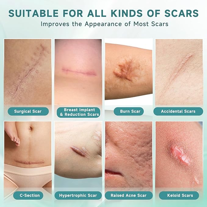Scar Suite Bundle, Advanced Silicone Scar Cream and Scar Sheets, Advanced Scar Treatment for Surgery, Burns, and Injuries, Professional Grade Results-VivaGrace Women