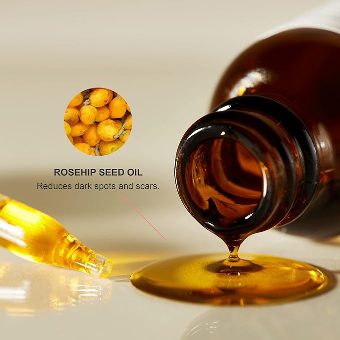 100% PURE Organic Rosehip Oil Moisturizer For Face, Body, Hair Hydrating Vitamins & Omega Fatty Acids Support Glowing, Plumped Up Youthful Skin - Natural Cold-Pressed Facial Radiance - Vegan - 1oz-VivaGrace Women