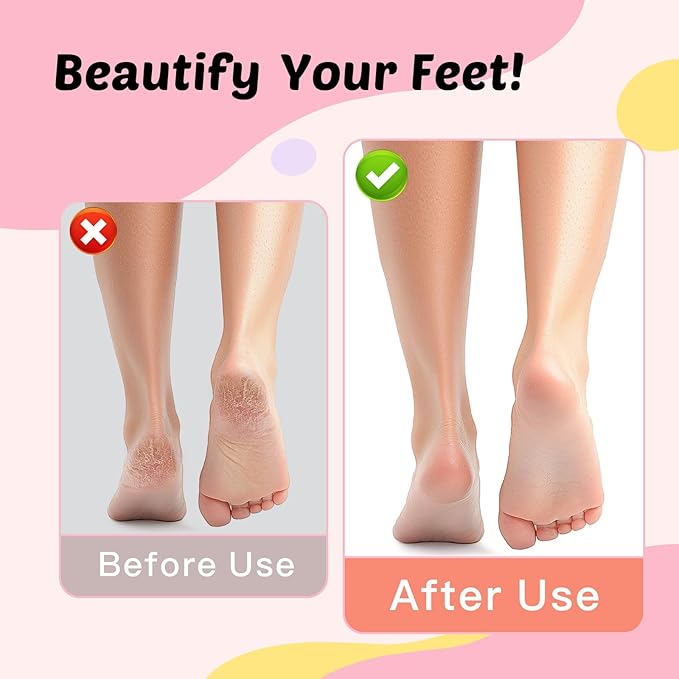 Electric Foot Callus Remover & Nail File - Electric Callus Remover for Feet, 9 Adjustable Speeds, 1800mAh Rechargeable, Portable Aluminum Body w/Type-C Charging for Home & Travel (Black)-VivaGrace Women