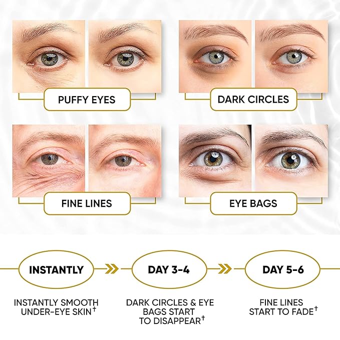 Golden Under Eye Patches for Puffy Eyes & Eye Bags & Wrinkles, Under Eye Patches for Dark Circles,Collagen for Eye Bags, Under Eye Collagen Patches-VivaGrace Women