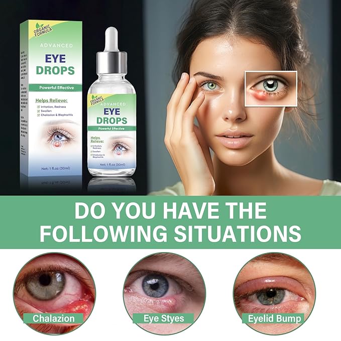 Stye Eye Treatment, Stye Eye Drops Serum for Styes Chalazion and Blepharitis, Chalazion Remover Fast Relief, Restore Healthier Eye Skin, 30ml-VivaGrace Women