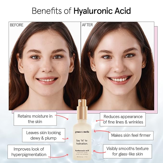 grace & stella Award Winning Hyaluronic Acid Serum (50ml/1.7 fl oz) Hydrating Hyaluronic Acid Serum for Face - Acido Hialuronico for Women - Remove Fine Lines, Wrinkles, Anti Aging - Vegan Skincare-VivaGrace Women