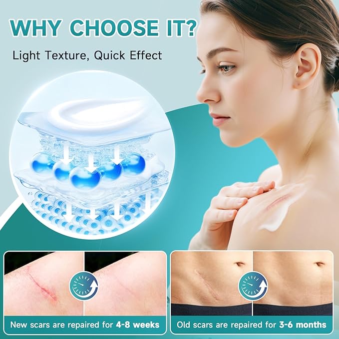 Advanced Scar Cream, Silicone Gel for Scars, Professional Scar Removal Cream for Surgical Scars, Stretch Marks, Old and New Scars 1.7 oz(50ml)-VivaGrace Women