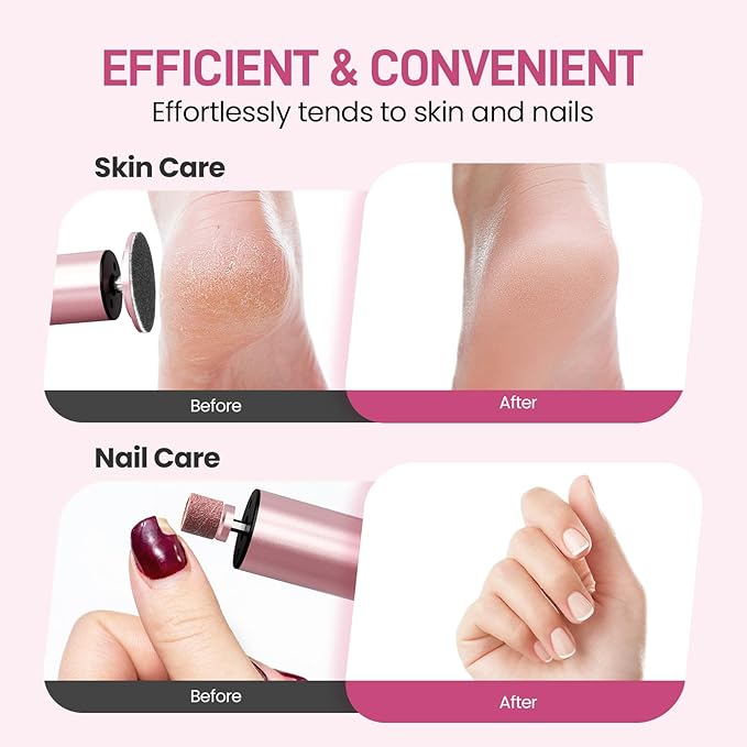 Electric Foot Callus Remover, 2 in 1 | 6 Speed Adjustable Foot File Nail Grinder with Sandpaper Disks, Professional Sander Pedicure Tool for Feet Dead Skin, Self Care Gifts for Women Mom Lover Friends-VivaGrace Women